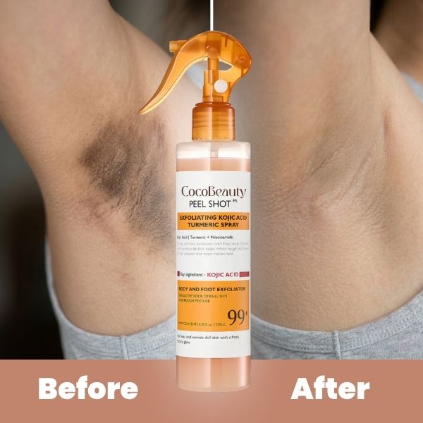 CocoBeauty - Body Peel Spray with Kojic + Turmeric