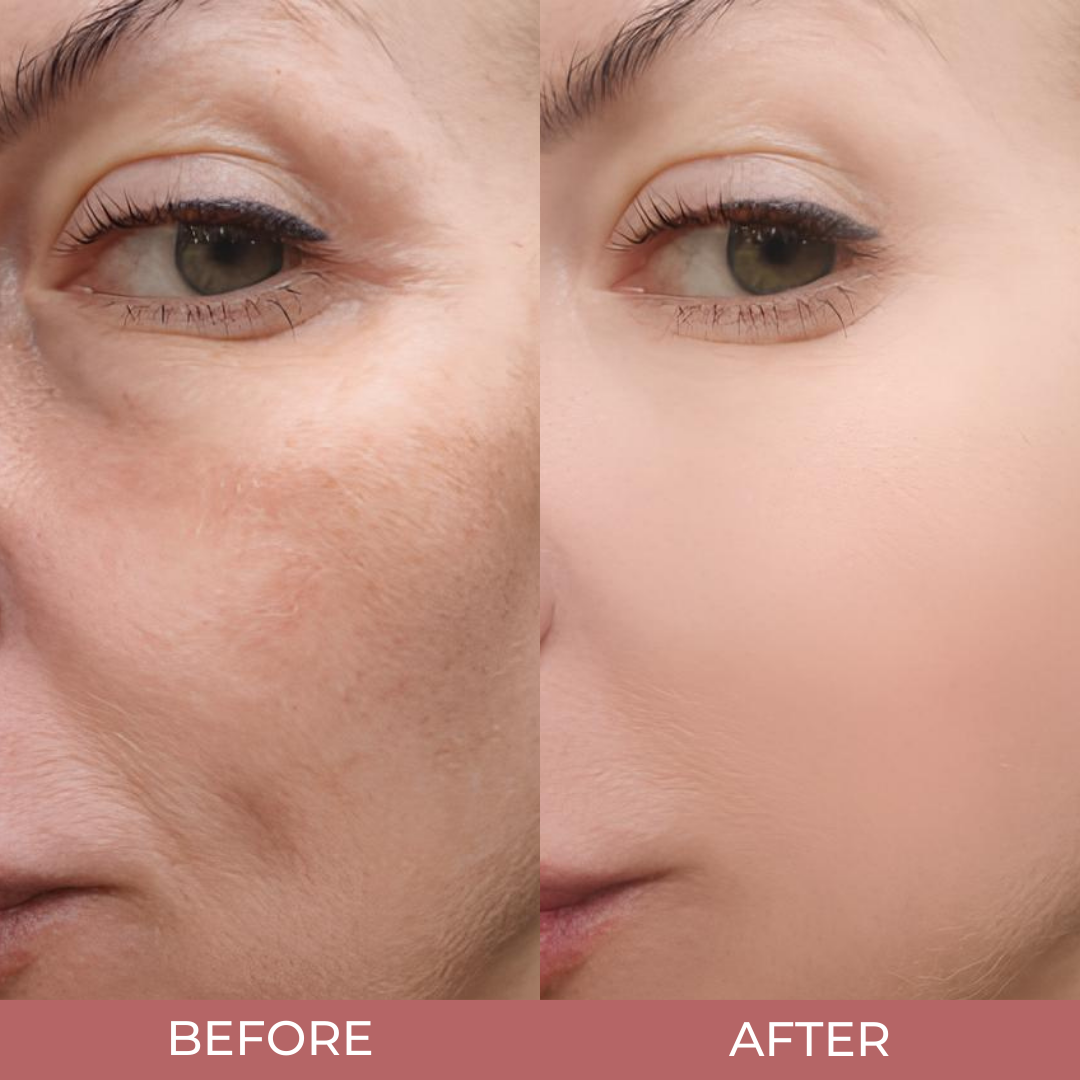CocoBeauty Peel Shot Glow Rice Ampoule Duo