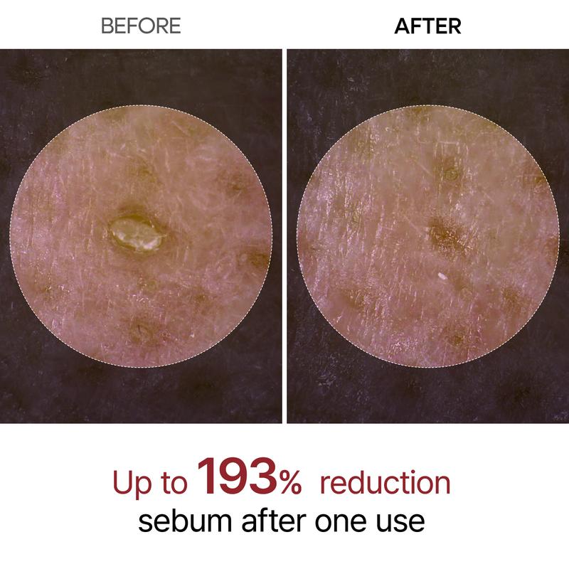 CocoBeauty Peel Shot Glow Rice Ampoule Duo