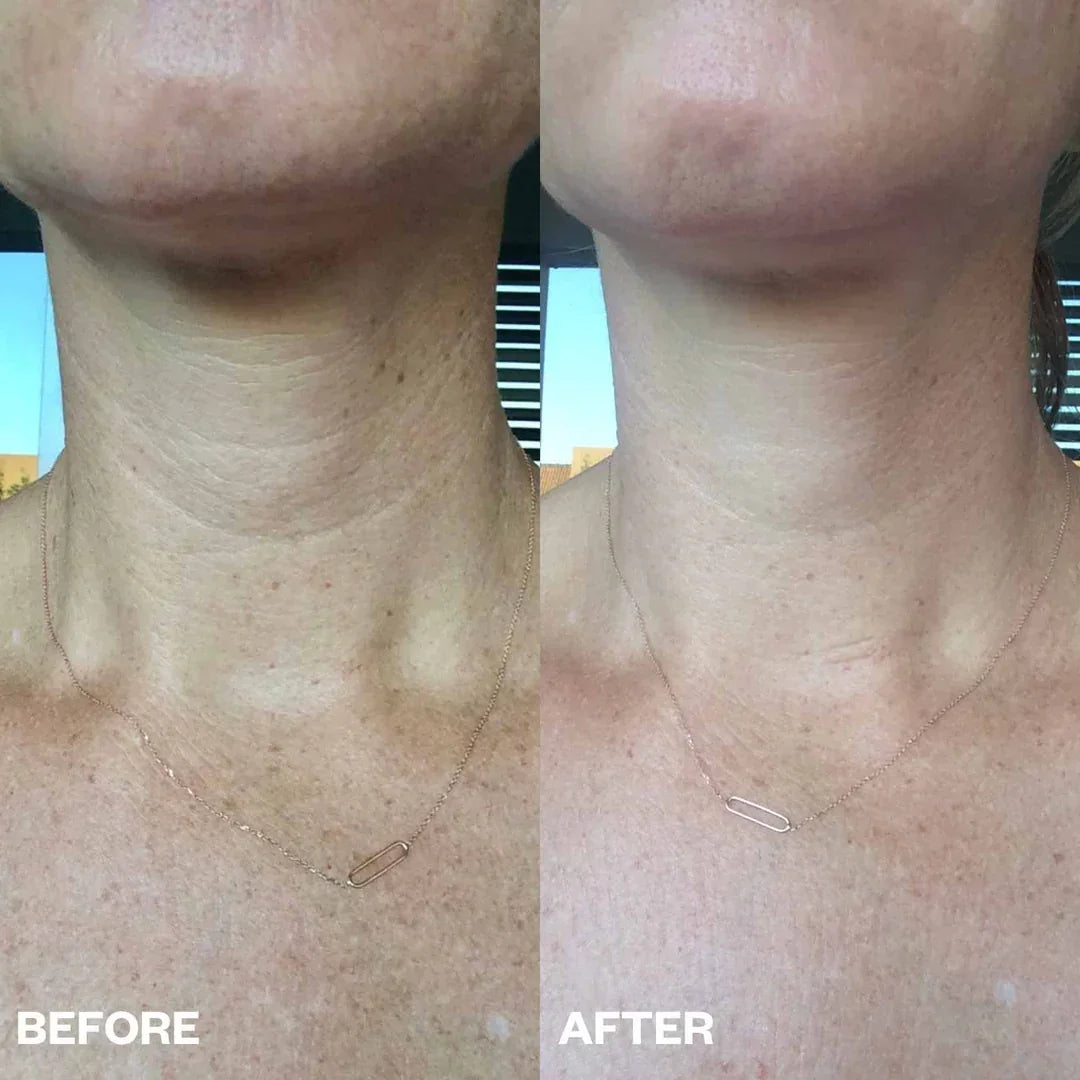 Bio-Collagen Neck Patches