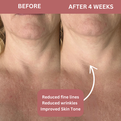 Bio-Collagen Neck Patches