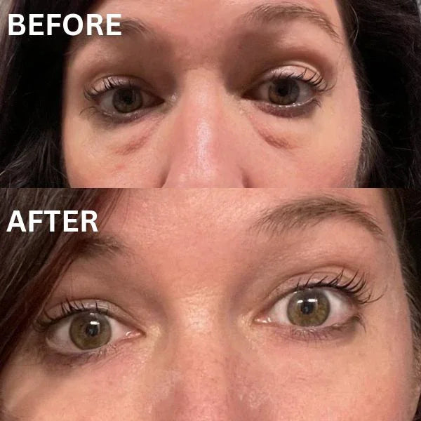 InstantFirm Collagen Eye Patches
