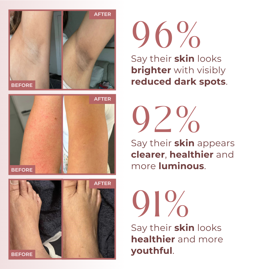 CocoBeauty Peel Shot - Kojic + Turmeric Body Peel Spray