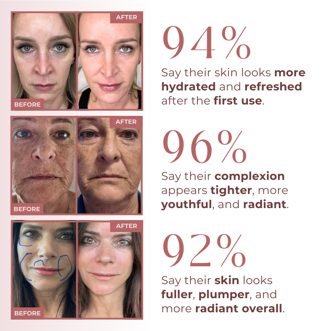 PureO2 - Bioactive Delivery MicrOxygenation