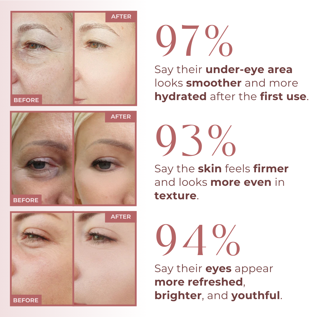 Bakuchiol Peptide Eye Repair