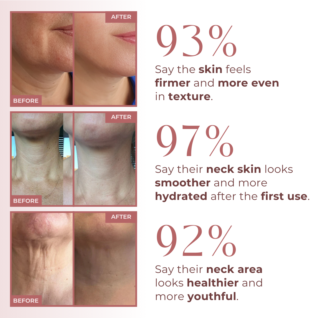 Bio-Collagen Neck Patches