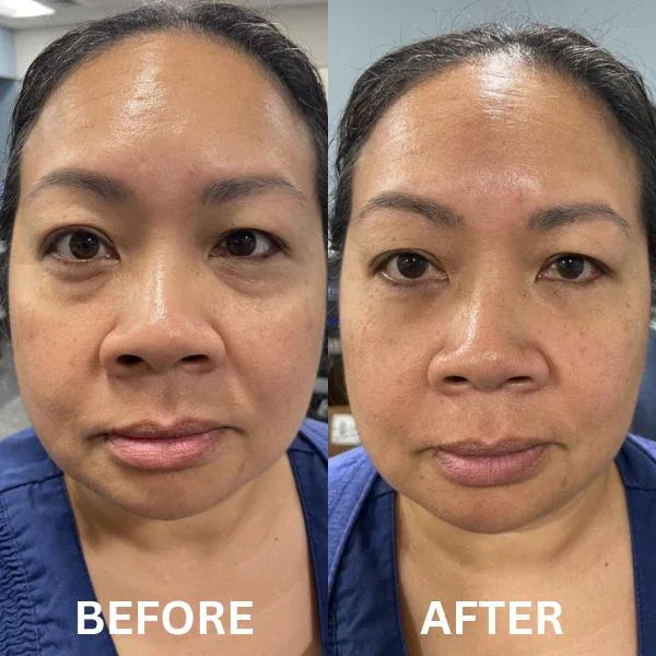 InstantFirm Collagen Eye Patches