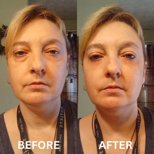 InstantFirm Collagen Eye Patches
