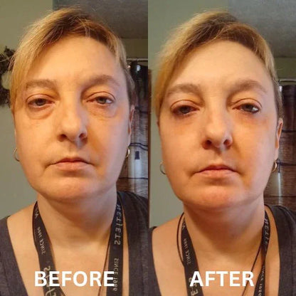 Instant Eye Lift Set