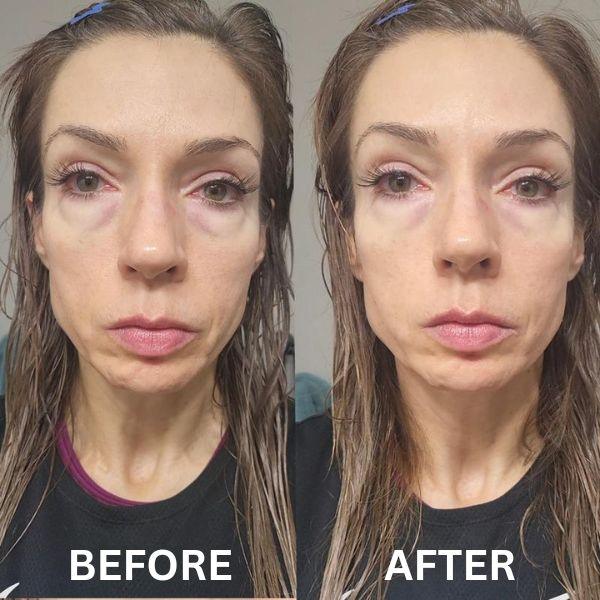 InstantFirm Collagen Eye Patches