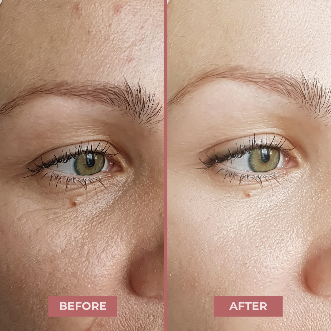 Hyaluronic Acid Serum