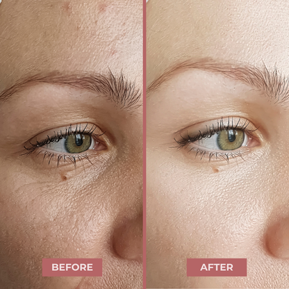 Hyaluronic Acid Serum