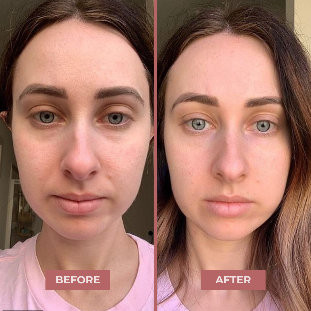 Bio-Collagen Eye Patches