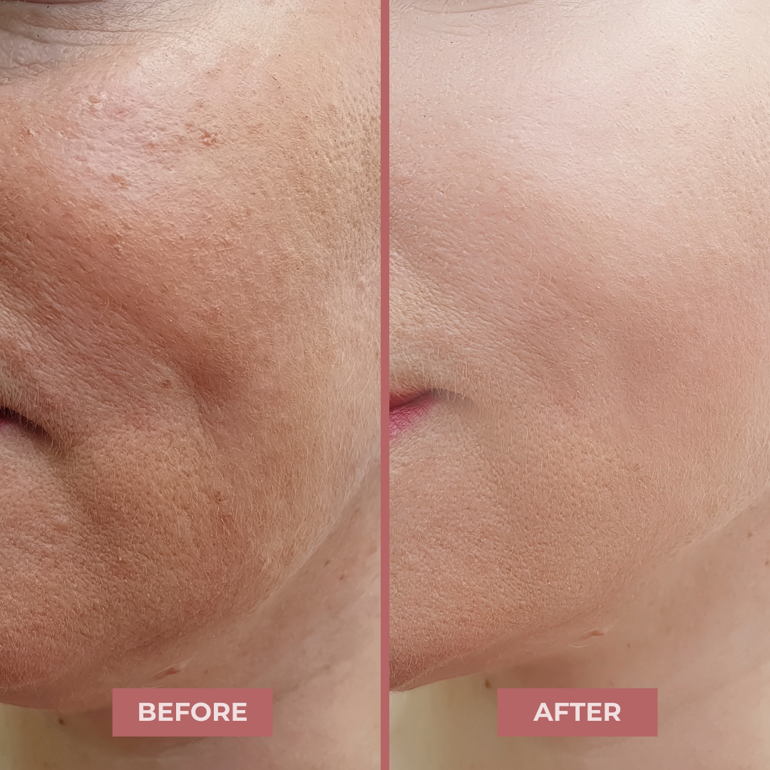 BioLift NAD+ Peptide Serum by CocoBeauty