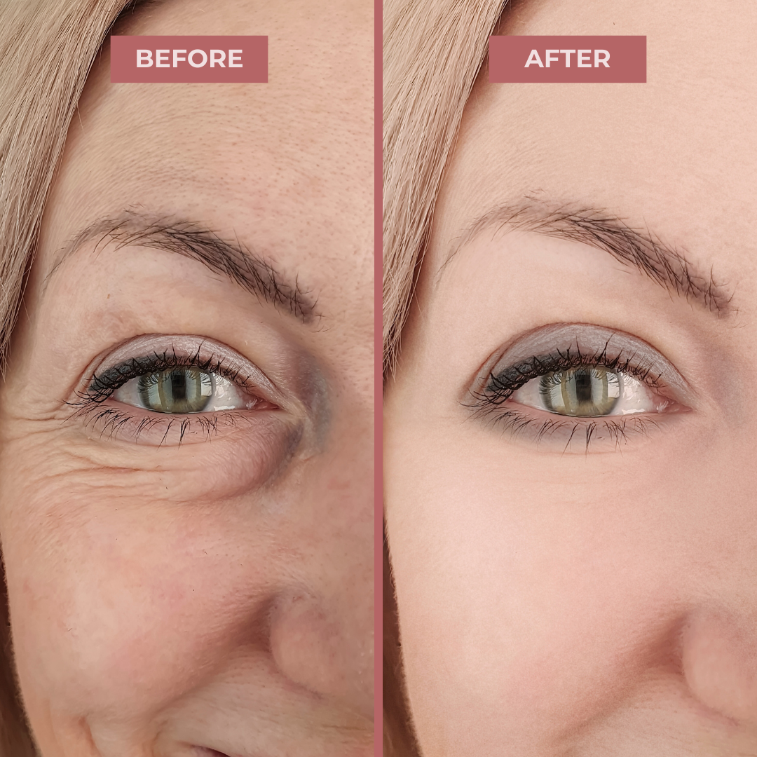 InstantFirm Collagen Eye Patches