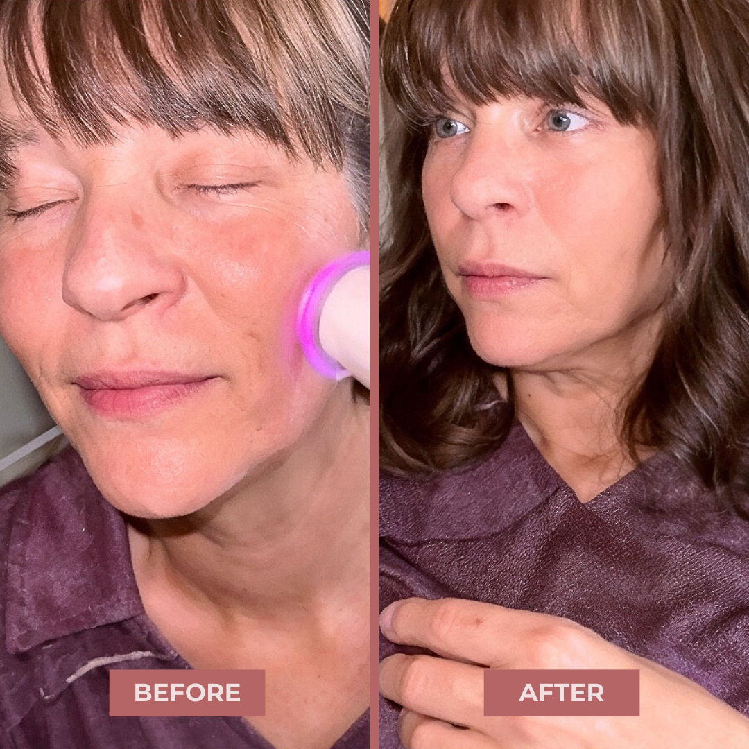 PureO2 - Bioactive Delivery MicrOxygenation