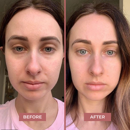 Bio-Collagen Eye Patches