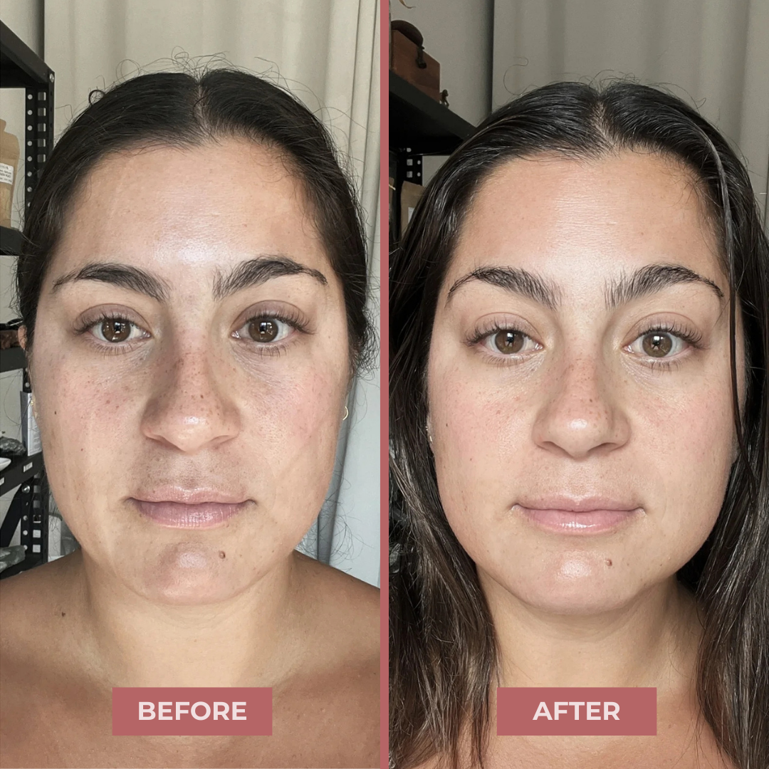 CocoBeauty LuxeLift™ Lymphatic Drainage Roller