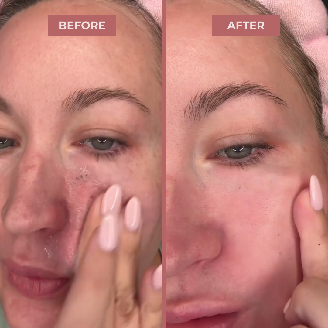 CocoBeauty Peel Shot Glow Rice Ampoule