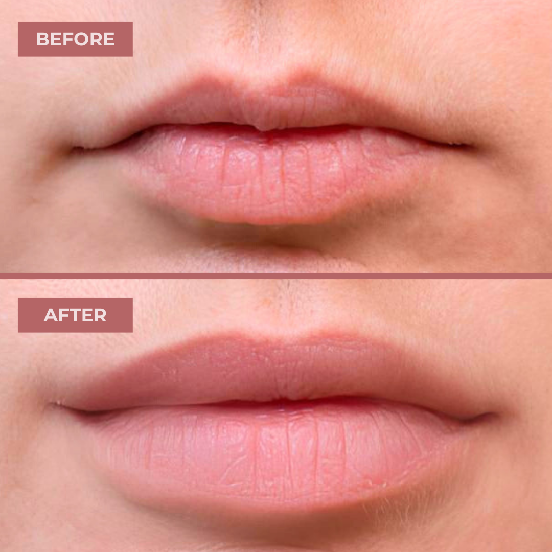 GlowPump Lips Instant Volumizing Shot