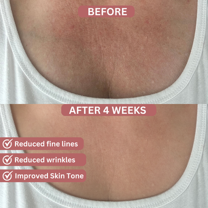 Bio-Collagen Chest Patches