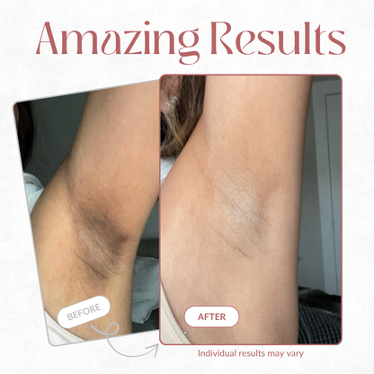 CocoBeauty Peel Shot - Kojic + Turmeric Body Peel Spray