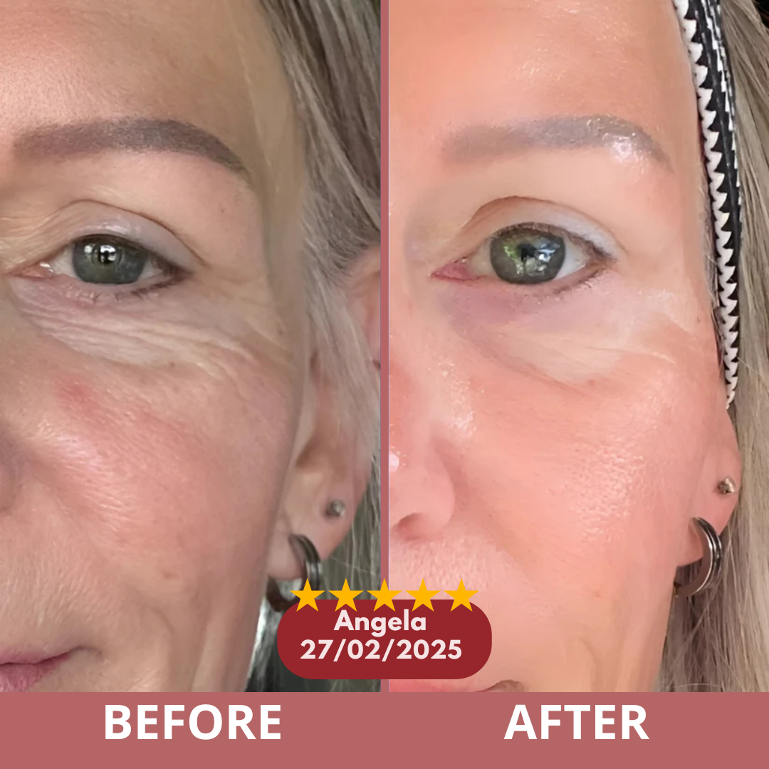 Before and after customer result