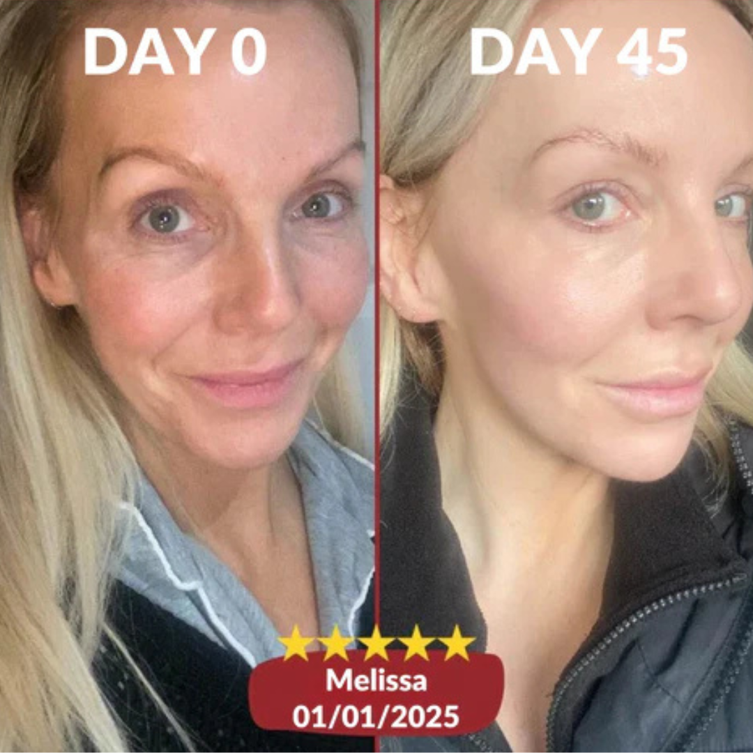 Before and after customer result