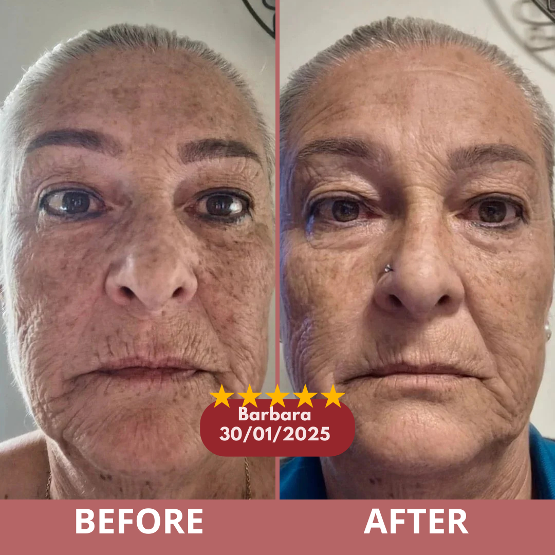 Before and after customer result