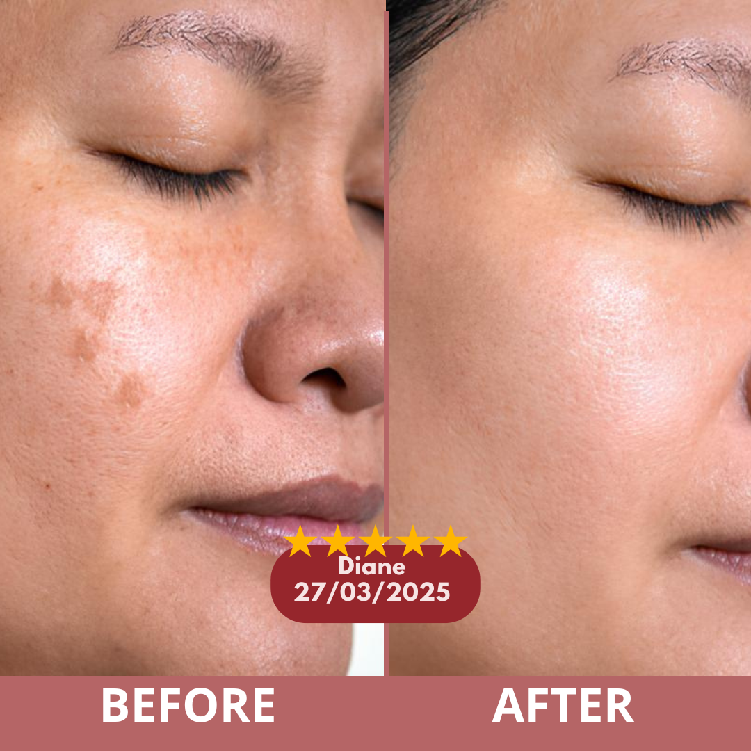 Before and after customer result