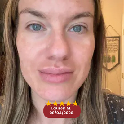 Customer sunscreen review image 2