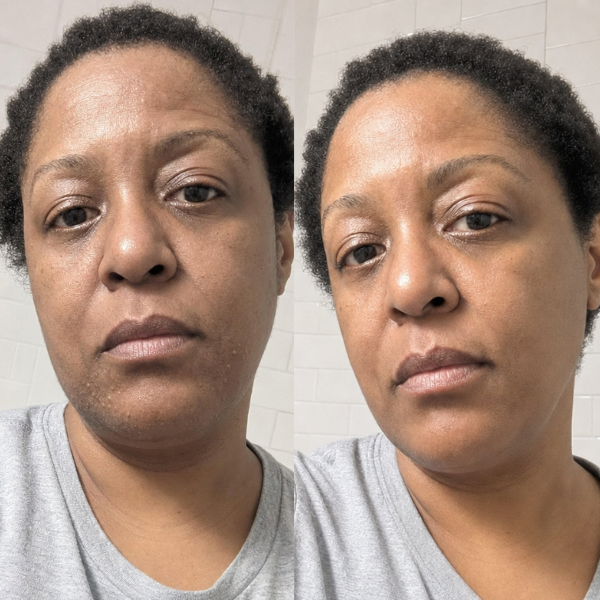 Three skin concerns in their forties