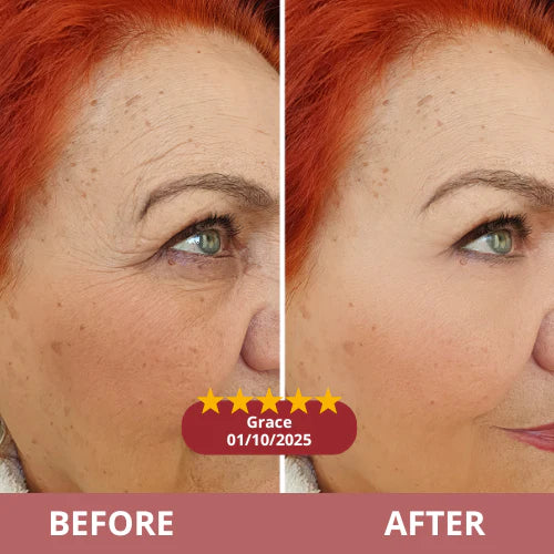 Zombie Pack - Tighten, Lift & Smooth in 10 Minutes