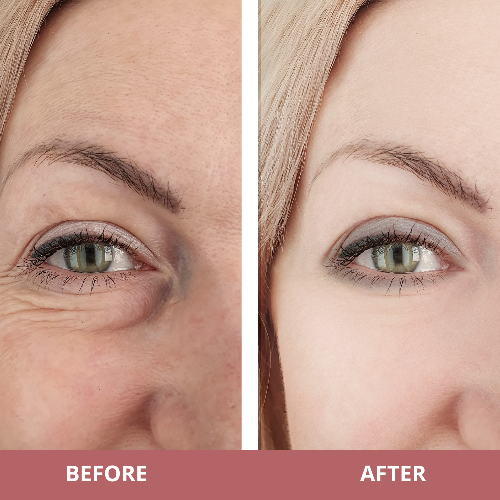 Bakuchiol Peptide Eye Repair